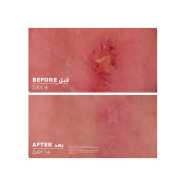 La Roche Posay Cicaplast B5+ Ultra Repairing Balm 100ML