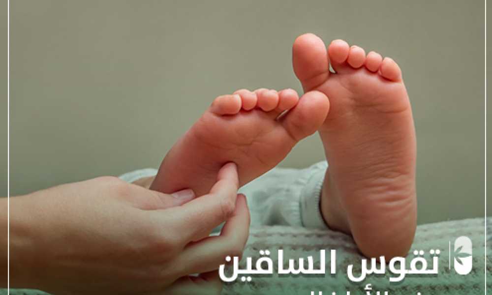 تقوس الساقين عند الأطفال ؟ تعرف على أسبابه وطرق علاجه