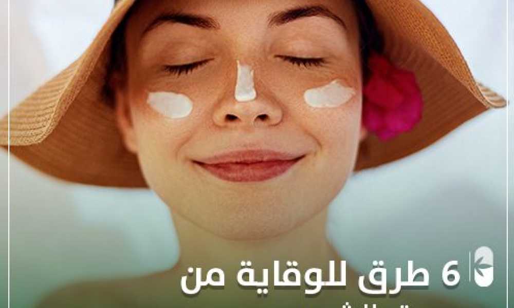 حروق الشمس و 6 طرق للوقاية منها