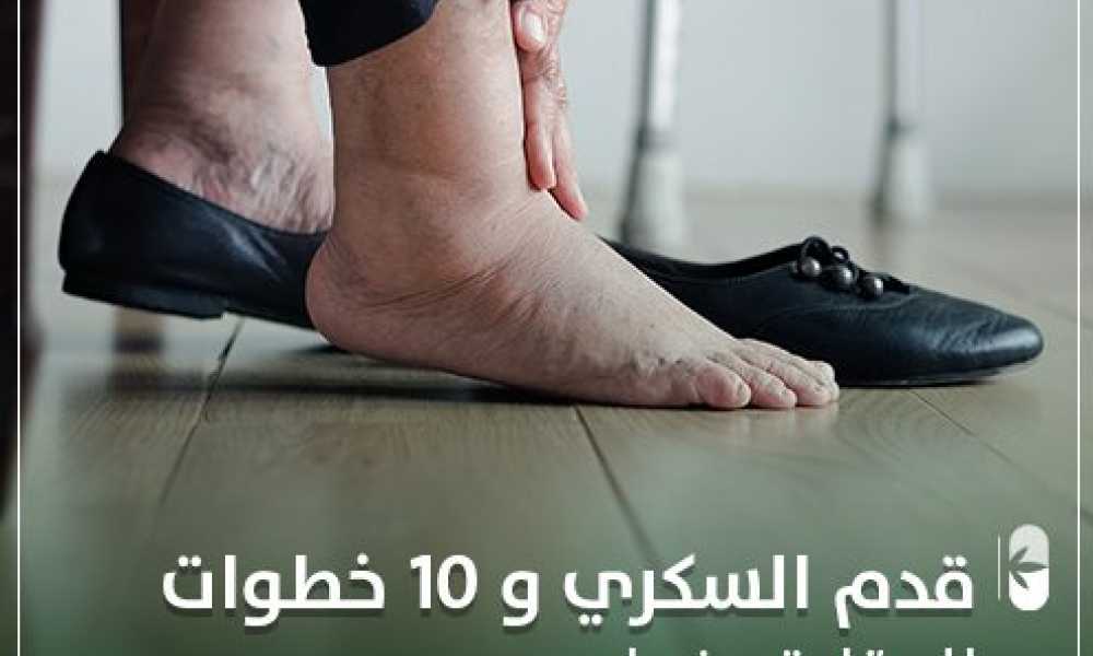 قدم السكري و 10 خطوات للوقاية منها