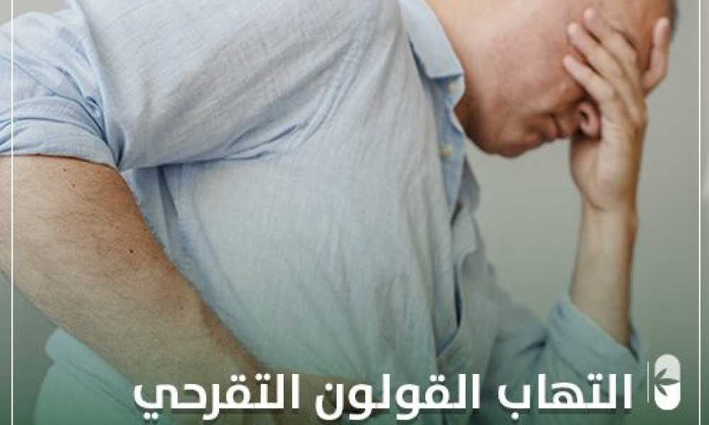 أسباب وعلاج التهاب القولون التقرحي