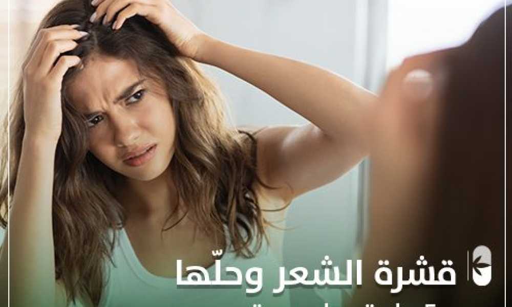 قشرة الشعر و حلها ب 5 طرق طبيعية