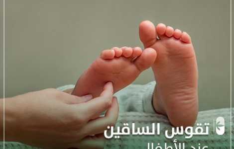 تقوس الساقين عند الأطفال ؟ تعرف على أسبابه وطرق علاجه