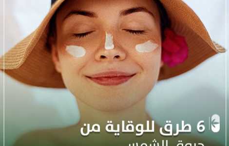 حروق الشمس و 6 طرق للوقاية منها