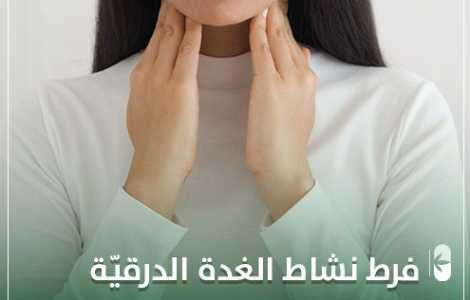 فرط نشاط الغدة الدرقية