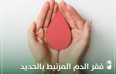 فقر الدم الناتج عن نقص الحديد
