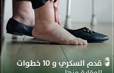 قدم السكري و 10 خطوات للوقاية منها