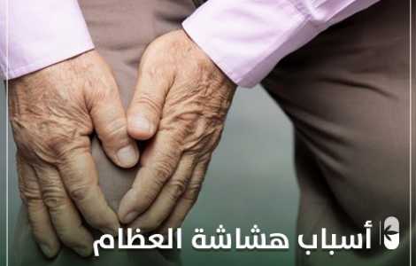 هشاشة العظام و 8 أسباب لها