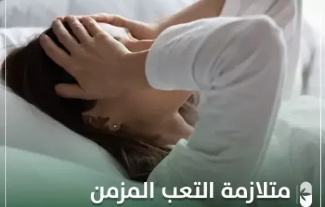 متلازمة التعب المزمن