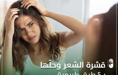 قشرة الشعر و حلها ب 5 طرق طبيعية