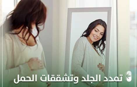 تمدد الجلد وتشققات الحمل