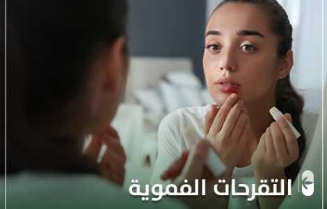 التقرحات الفموية و 7 طرق للوقاية منها